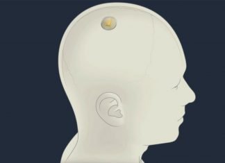 Elon Musk presenta Neuralink