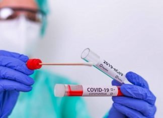 OPS: Arribaron a Venezuela 340 Mil pruebas de antígeno para detección de Coronavirus