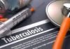 Estiman que cifras por tuberculosis se mantienen en aumento