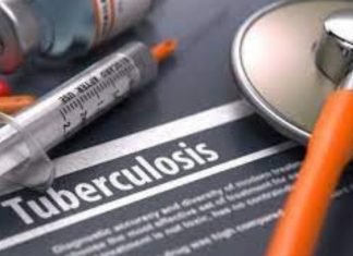 Estiman que cifras por tuberculosis se mantienen en aumento