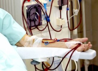 Máquinas de hemodiálisis dañadas afectan a más de mil pacientes en Lara