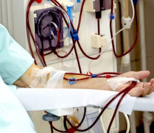 Máquinas de hemodiálisis dañadas afectan a más de mil pacientes en Lara