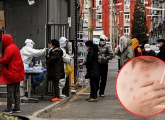 China refuerza controles fronterizos ante la propagación del mpox